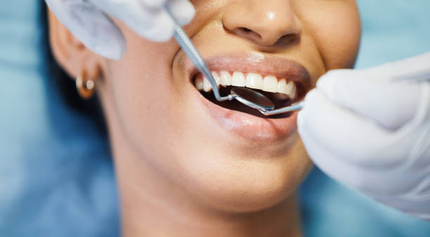 Best Emergency Root Canal Treatment in Jim Thorpe, PA