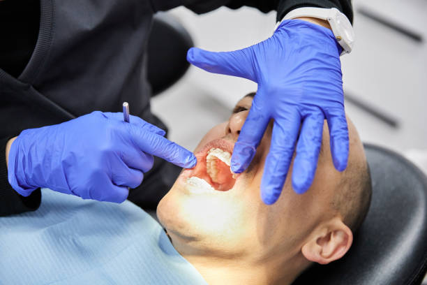 Best Emergency Treatment for Dental Infections or Abscesses in Jim Thorpe, PA